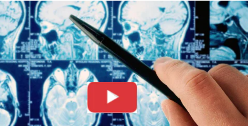 Does mobile phone radiation cause cancer?