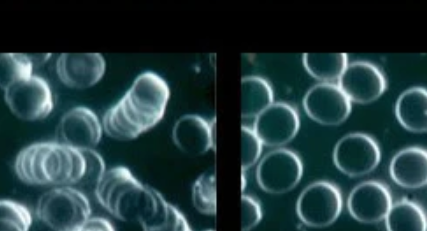 Blood analysis showing the harmful effects from using wireless communication device
